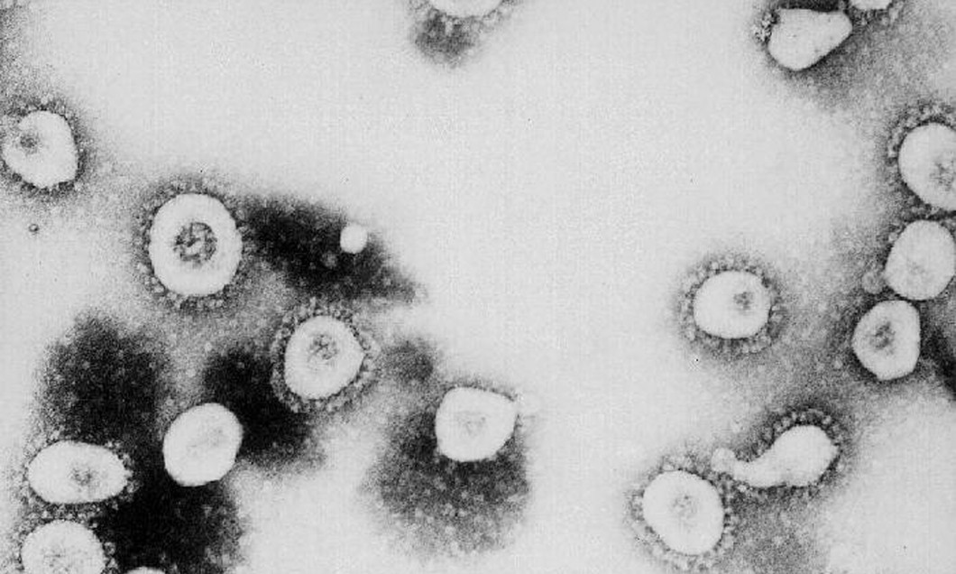 CDC Says SARS Might Be A Form Of The Coronavirus