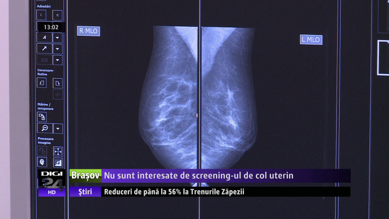 SCREENING COL UTERIN COVASNA VO