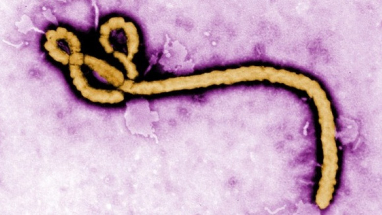 virus ebola 1