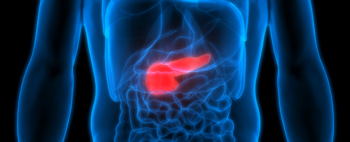 cancer de pancreas (1)