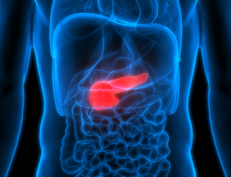 cancer de pancreas (1)