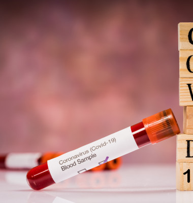 Coronavirus,(covid-19),Test.,Blood,Sample