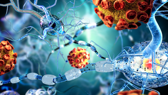 COVID-19 de lungă durată. Cât timp persistă virusul în creier. Pare „să aibă un impact asupra producţiei de dopamină”