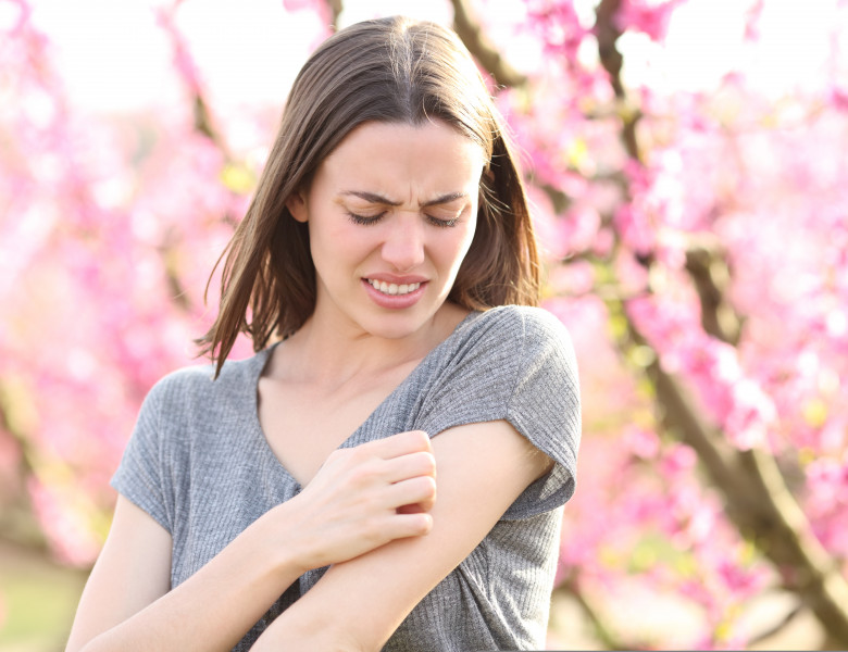 Stressed,Woman,Scratching,Itchy,Arm,After,Insect,Bite,In,A