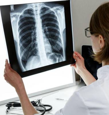 radiografie pulmonara