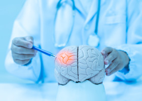 Neurologist,Hand,Pointing,Brain,Anatomy,Human,Model,And,Brain,Disease