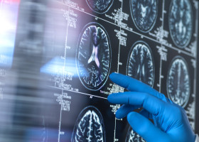 Neurology research, conceptual image Scientist viewing a patient s brain MRI (magnetic resonance imaging) scan for agein