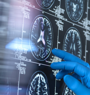 Neurology research, conceptual image Scientist viewing a patient s brain MRI (magnetic resonance imaging) scan for agein