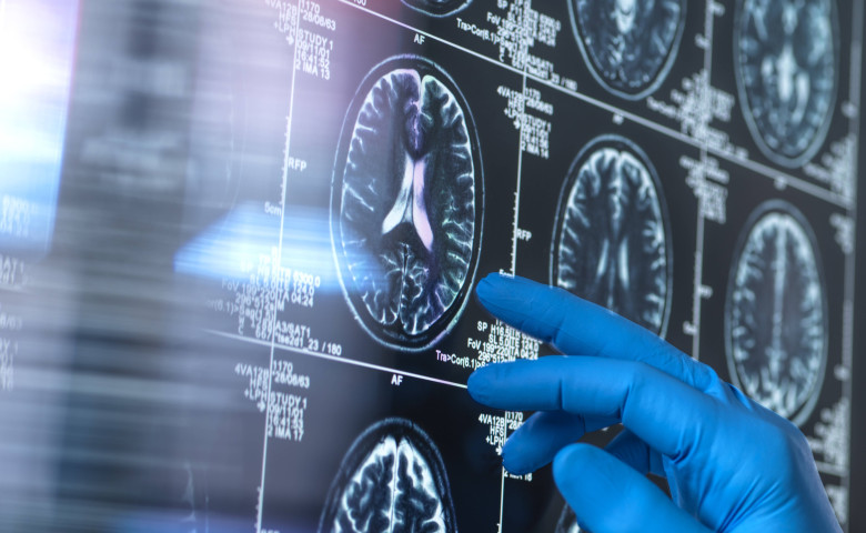 Neurology research, conceptual image Scientist viewing a patient s brain MRI (magnetic resonance imaging) scan for agein
