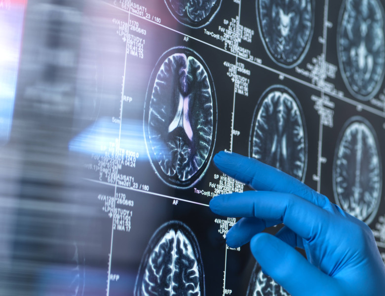 Neurology research, conceptual image Scientist viewing a patient s brain MRI (magnetic resonance imaging) scan for agein