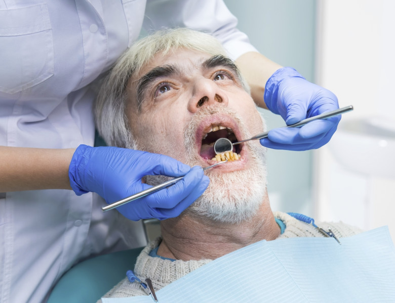 dinti, dantura, probleme dentare