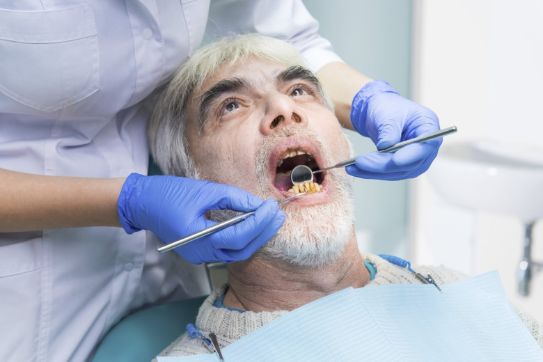 dinti, dantura, probleme dentare
