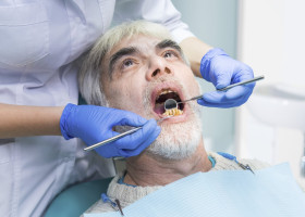 dinti, dantura, probleme dentare