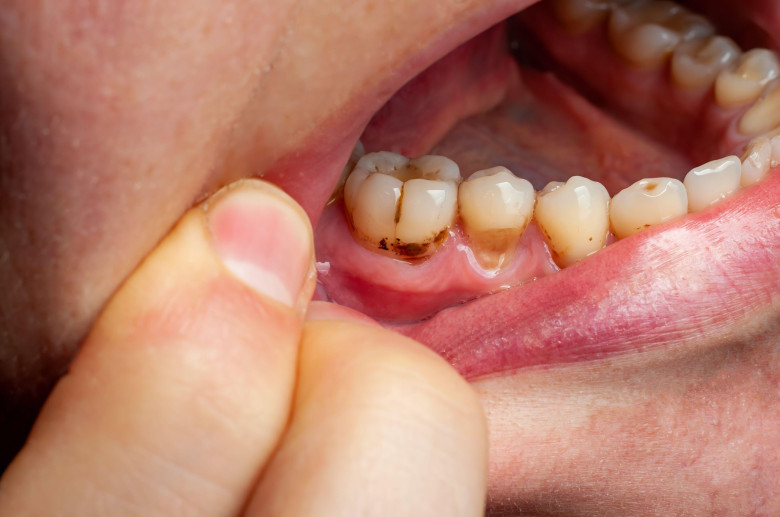probleme dentare