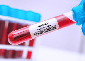 Serratia marcescens