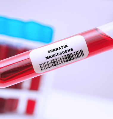 Serratia marcescens