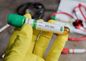 HPV DNA vaccination drug in green gloved hands. Medical concept