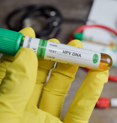 HPV DNA vaccination drug in green gloved hands. Medical concept
