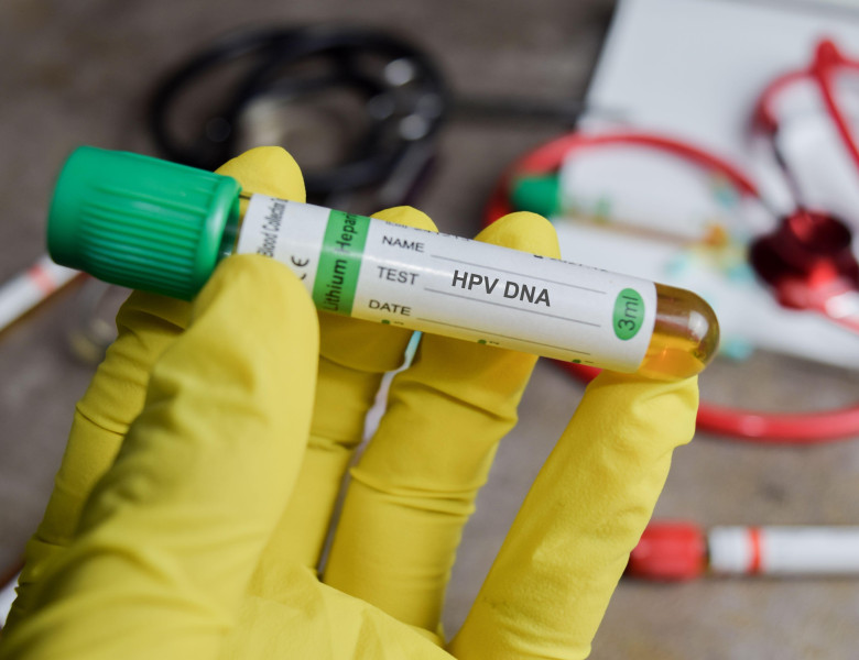 HPV DNA vaccination drug in green gloved hands. Medical concept