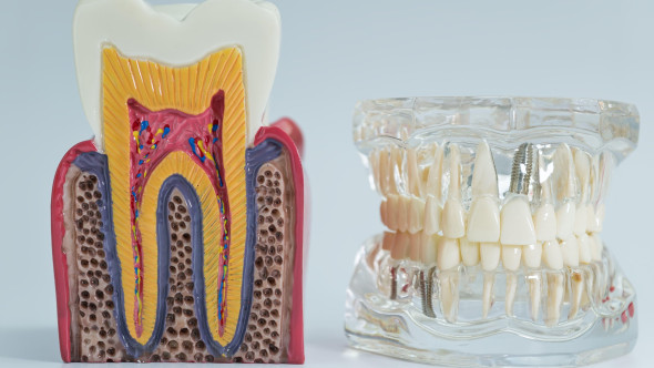 Cum îi afectează fumatul pe oamenii care-și fac implanturi dentare. Și cei cu dinți naturali au de suferit