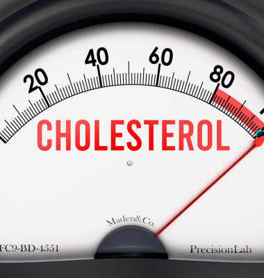 Cholesterol that is hitting a full scale, rising values, showing a very high level of cholesterol