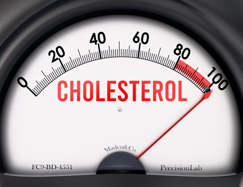 Cholesterol that is hitting a full scale, rising values, showing a very high level of cholesterol
