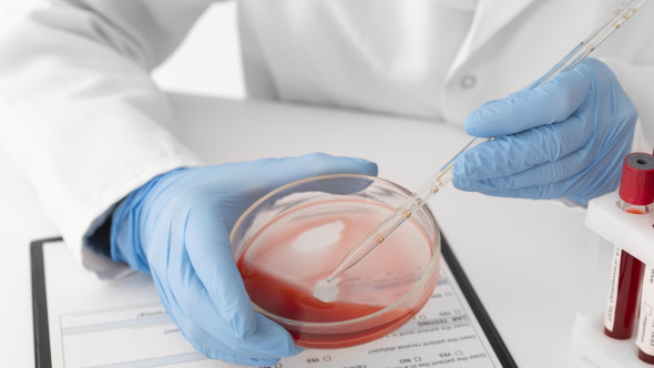 Ce este hemocromatoza, boală genetică supranumită "blestemul celtic". Simptomele afecțiunii, uneori evidente după zeci de ani