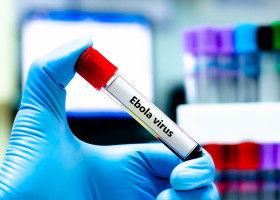Ebola/ Profimedia