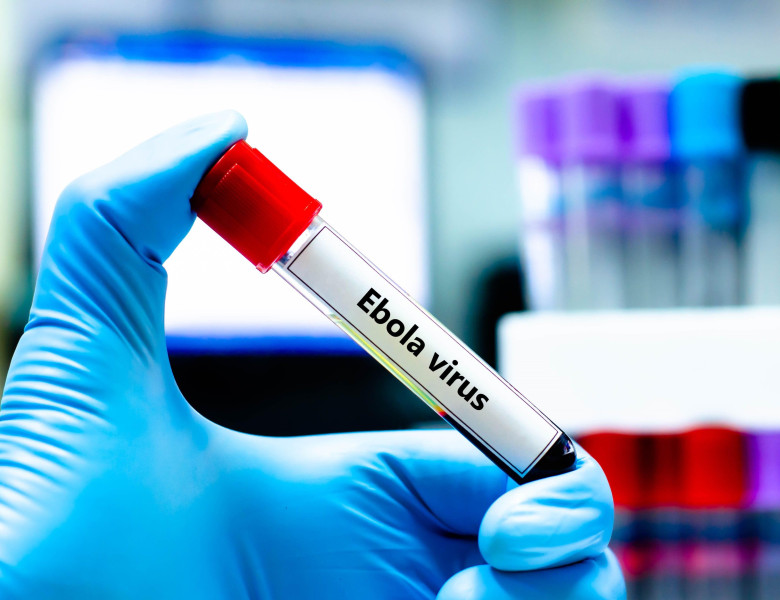 Ebola/ Profimedia