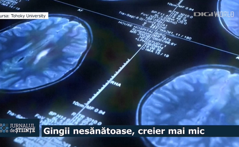 gingii si creier, jurnalul de stiinte