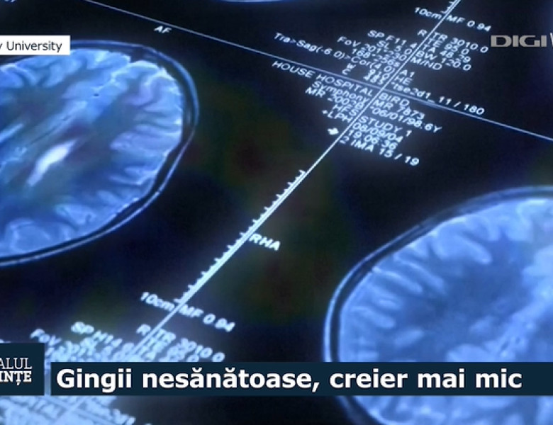 gingii si creier, jurnalul de stiinte