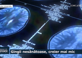 gingii si creier, jurnalul de stiinte
