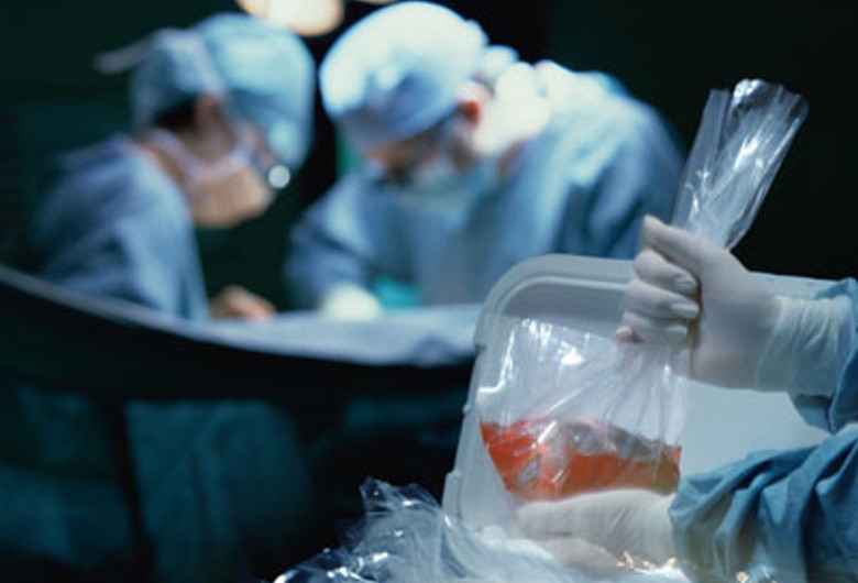 Transplant de organe