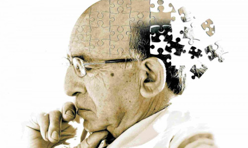 Alzheimer, demență, senil