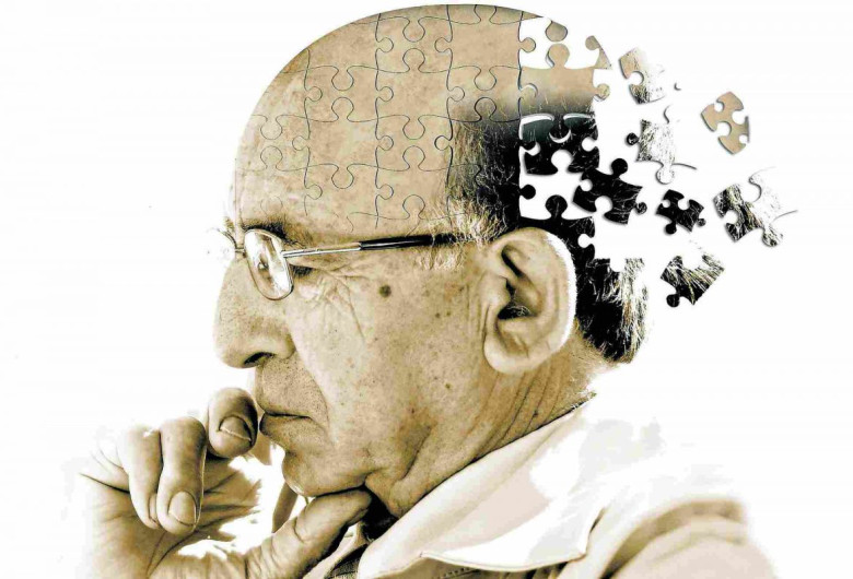 Alzheimer, demență, senil