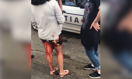 Fată însângerată, ignorată de polițiștii din Galați