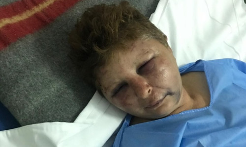 Femeie bătută de polițist în Potcoava
