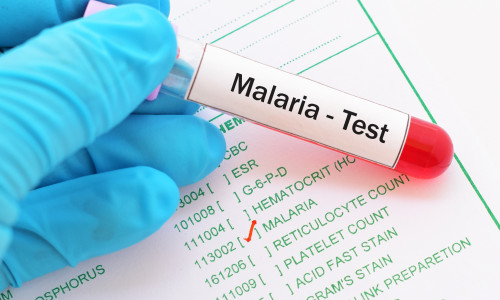 Blood,Sample,With,Requisition,Form,For,Malaria,Test