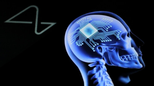 Neuralink Implants Brain Chip In Human