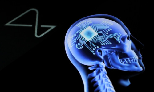 Neuralink Implants Brain Chip In Human