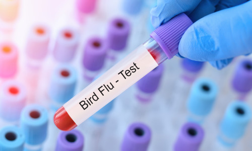 Doctor,Holding,A,Test,Blood,Sample,Tube,With,Bird,Flu