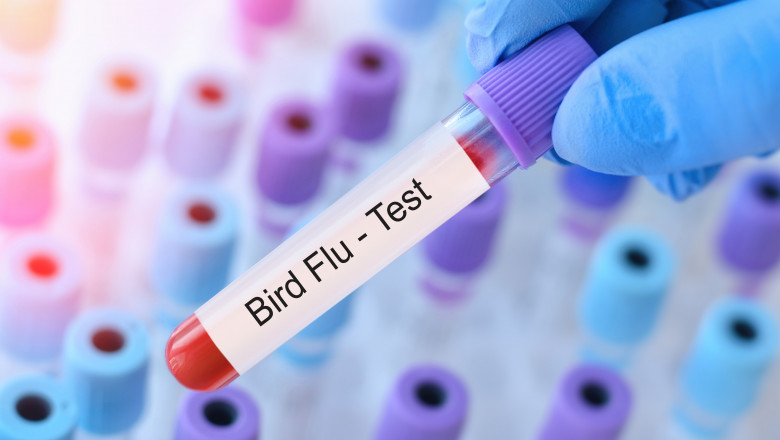 Doctor,Holding,A,Test,Blood,Sample,Tube,With,Bird,Flu