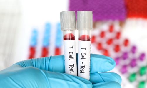 T,Cell,-,Test,,Blood,Sample,To,Analyze,In,The