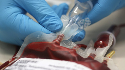 A,Bag,Of,Transfusion,Blood