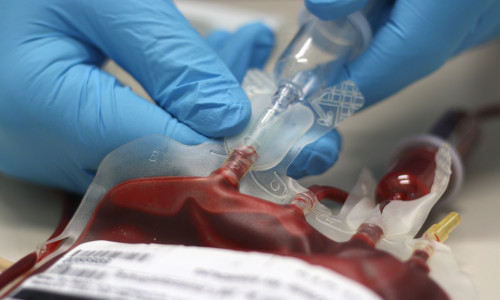 A,Bag,Of,Transfusion,Blood
