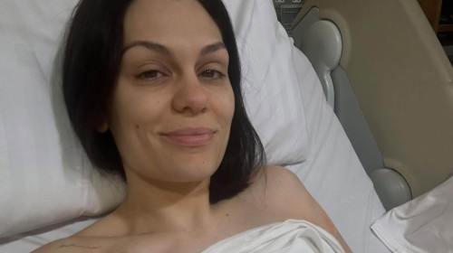 Jessie J
