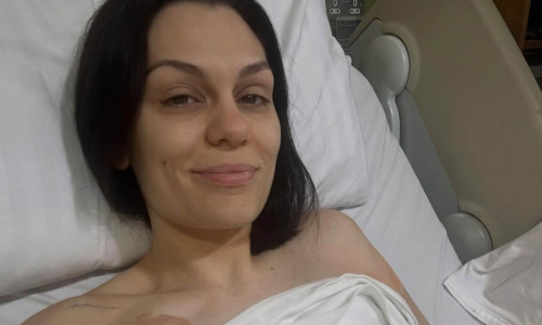 Jessie J