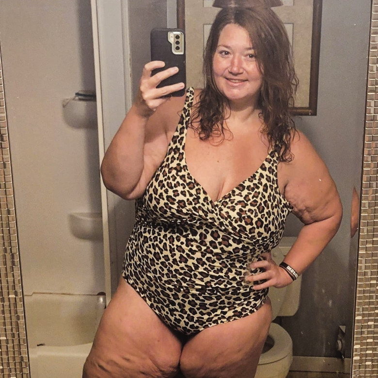Woman who dropped 310lbs WITHOUT fat jabs after feeling like 'prisoner' in own body proudly shows off excess skin in swimwear but still CAN'T go swimming