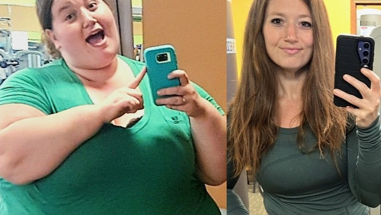 Woman who dropped 310lbs WITHOUT fat jabs after feeling like 'prisoner' in own body proudly shows off excess skin in swimwear but still CAN'T go swimming