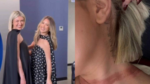 O influenceriță a fost „aproape decapitată” după ce eșarfa de mătase i s-a prins în mașină/ Foto: Captură video Instagram